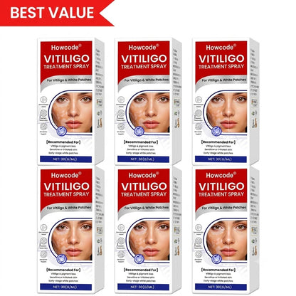 Howcode® Vitiligo Treatment Spray — Visible Results in Weeks, 100% Natural & Steroid-Free